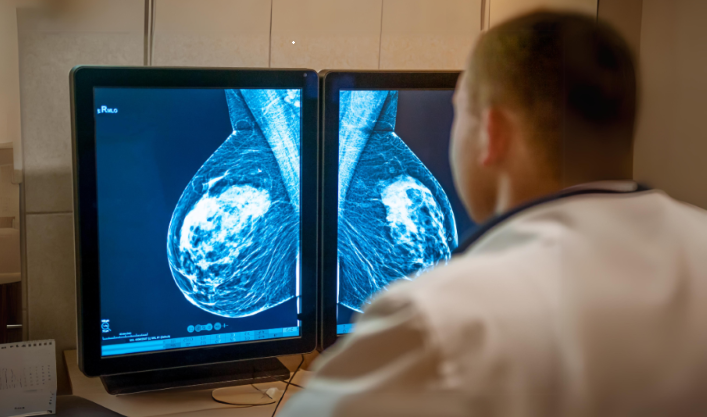 Côte d’Ivoire : 20 000 cas de cancer détectés par an, dont 5 000 du sein